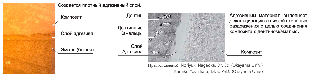 Ямакинбонд8